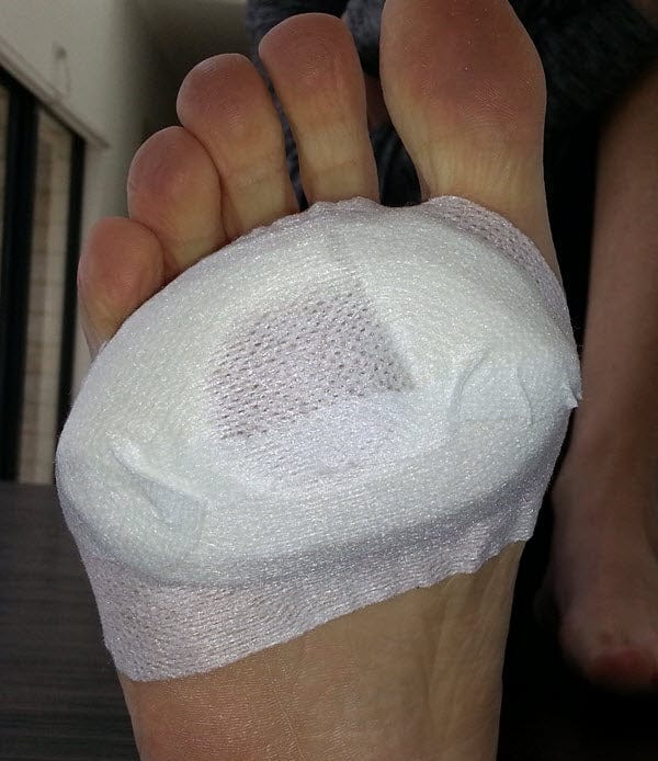 Fixomull Stretch Fixation Tape Tapes - Blister Prevention