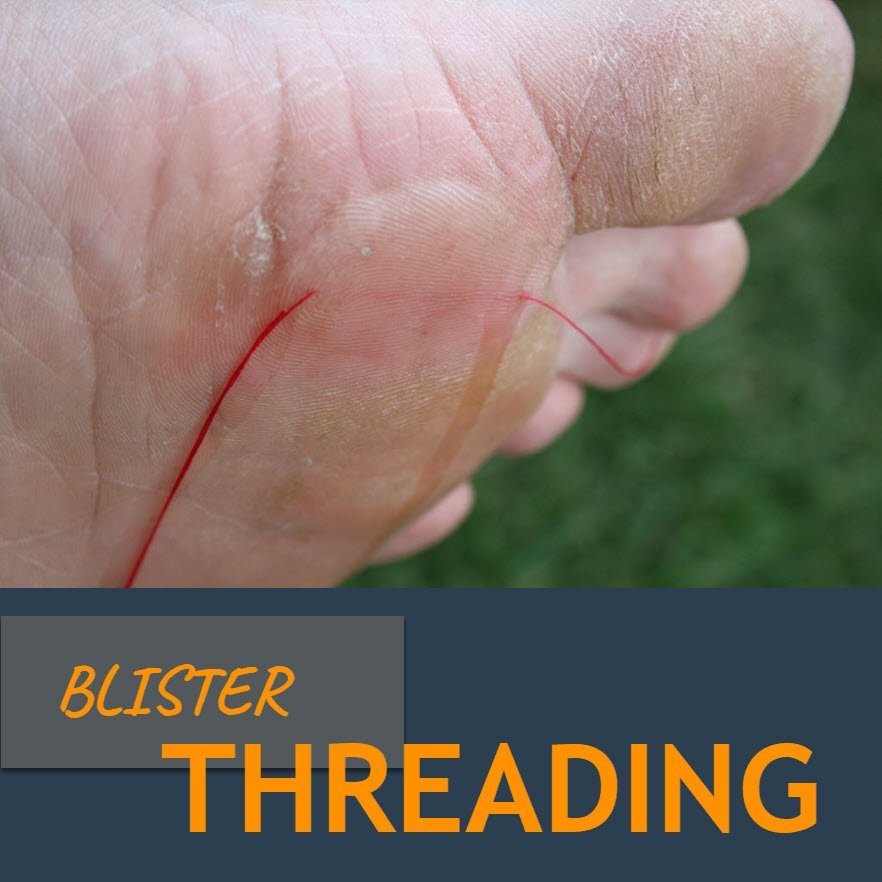 blister threading to drain a blister