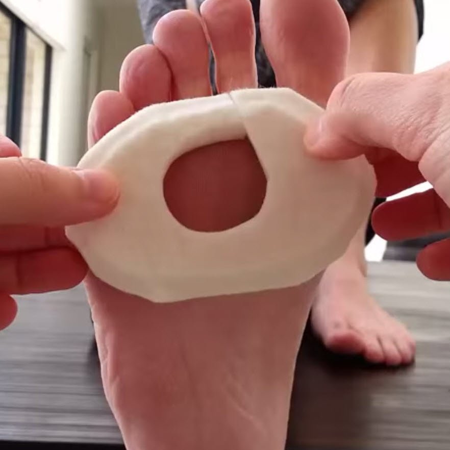 felt donut pad for blisters under the ball of the foot