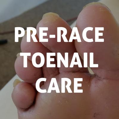 pre-race toenail care