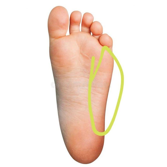 lateral midfoot blister location styloid process