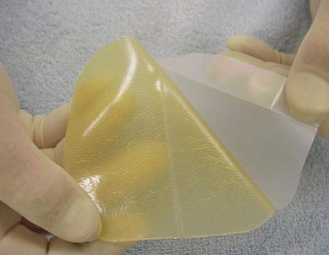Duoderm is a hydrocolloid dressing often used for ulcers 