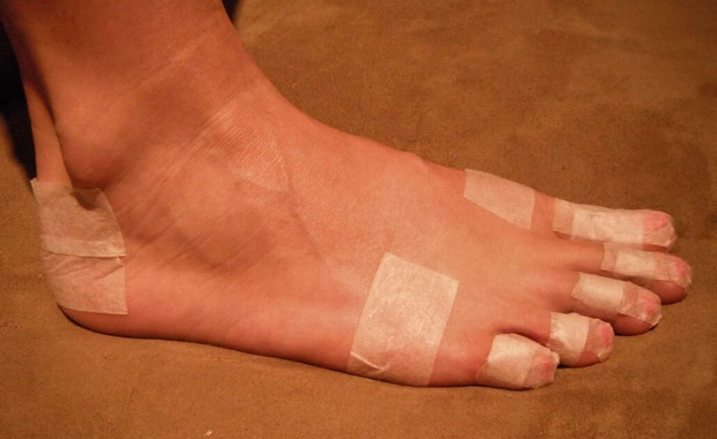 blister pre-taped study: blister prevention taping with paper tape
