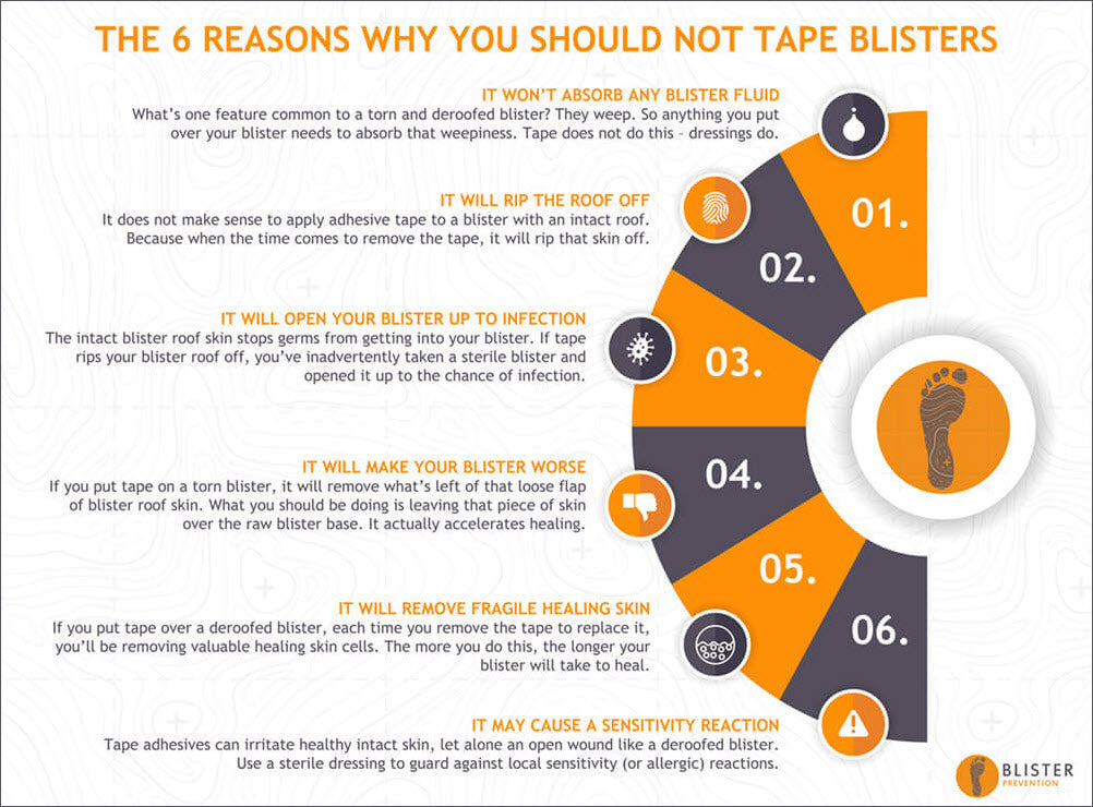 6 reasons why you should not tape blisters