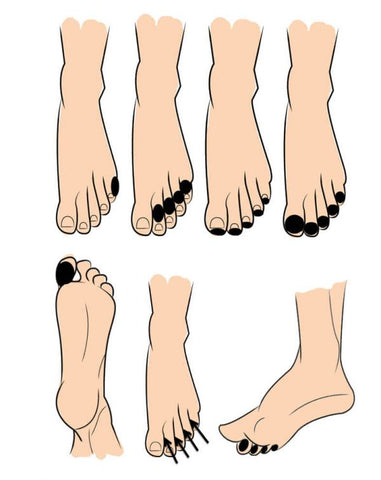 7 toe blister locations