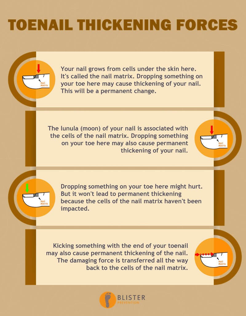 toenail thickening forces