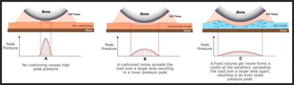 How gel toe protectors reduce pressure, including gel toe caps and toe sleeves