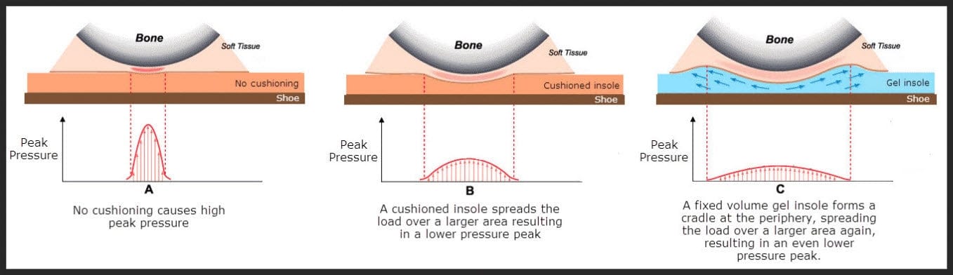 how cushioning reduces pressure