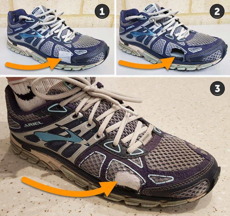 Cutting Holes In Running Shoes To Relieve Blisters