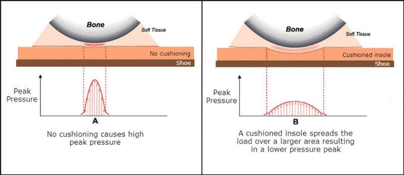 Gel has the potential to take pressure off a foot blister by increasing contact surface area