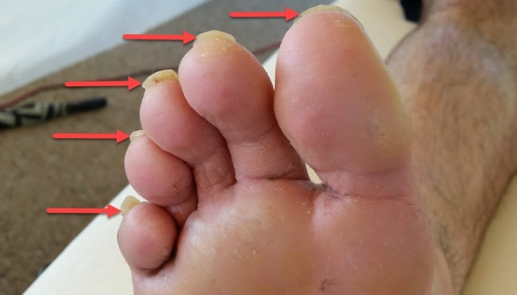 What All Runners Should Know Before Getting a Pedicure