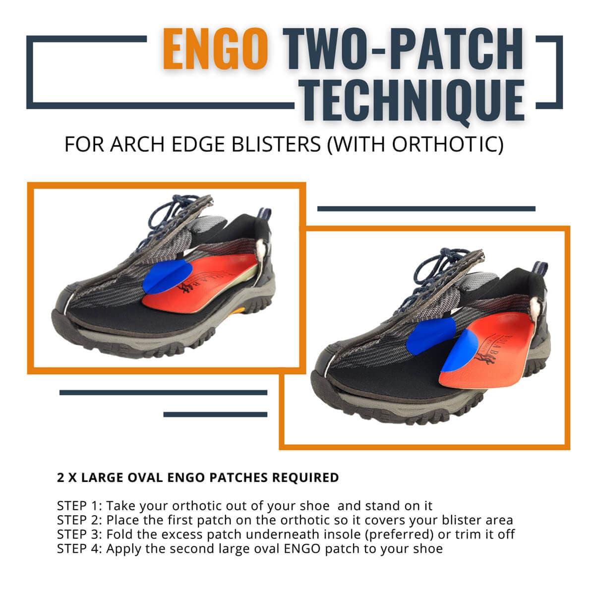 ENGO Blister Patches 4-Pack 6-Pack 30-Pack large oval patches using two patch technique for arch blisters with orthotics