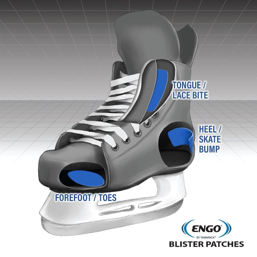 ENGO Patches in skates