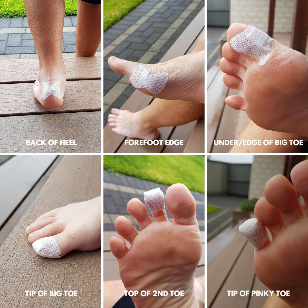 Livingstone Finger Dressings on feet
