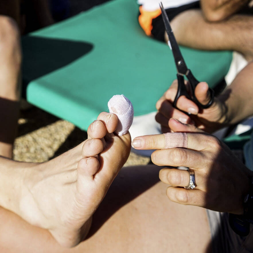toe blister taping techniques ©iancorless.com_Lanza2016-04072