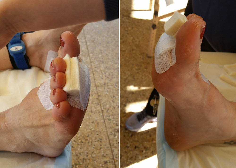 temporary felt toe-props at Adelaide