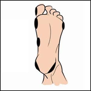 edge blister locations