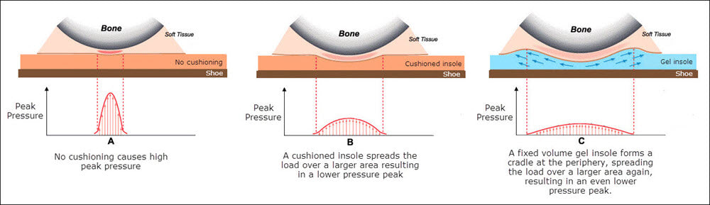 Cushioning reduces peak pressure (from Carlson, 2006)