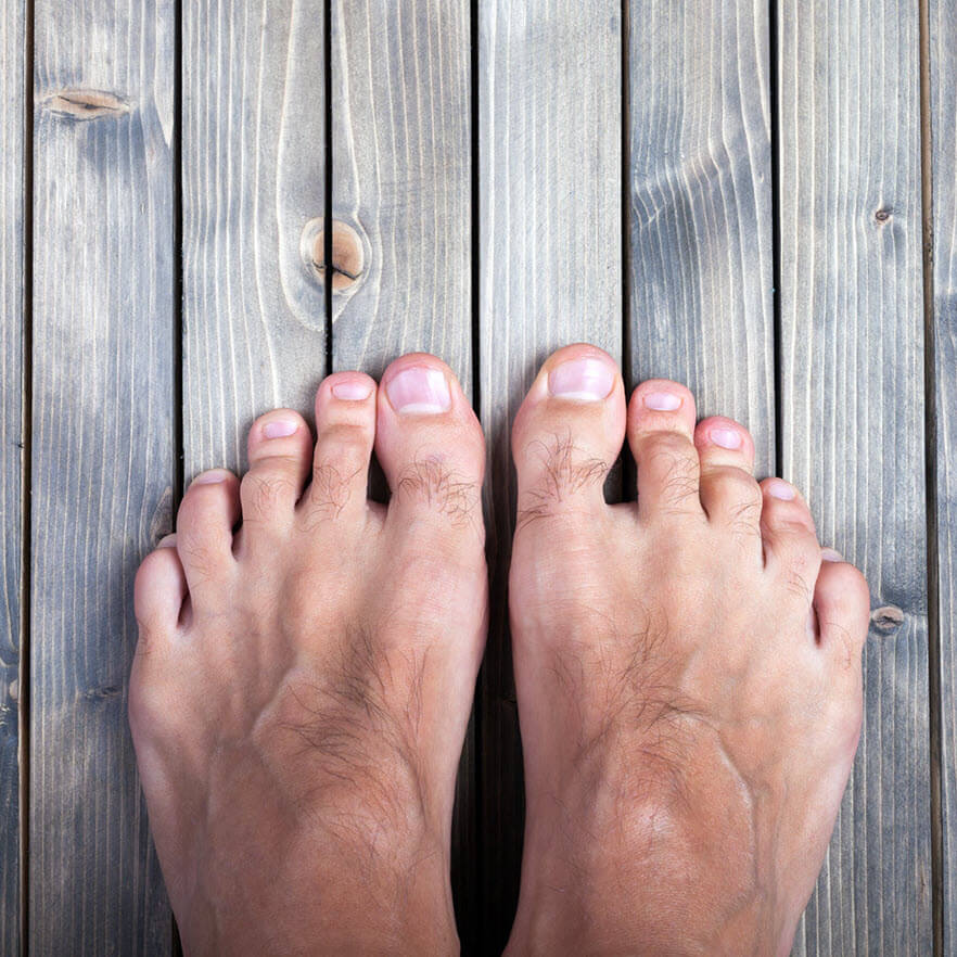 toe blister treatment for pinch toe blister