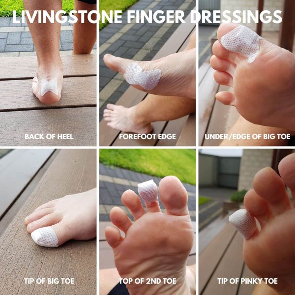 Livingstone Finger Dressings on feet