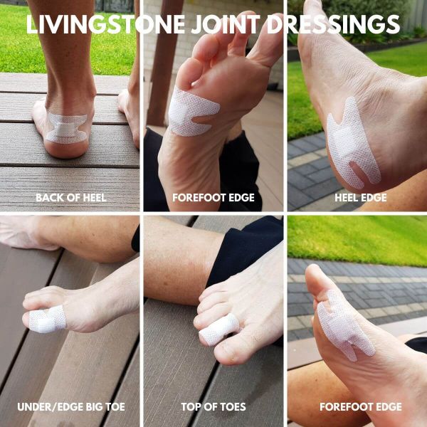 Livingstone Joint Dressings on feet