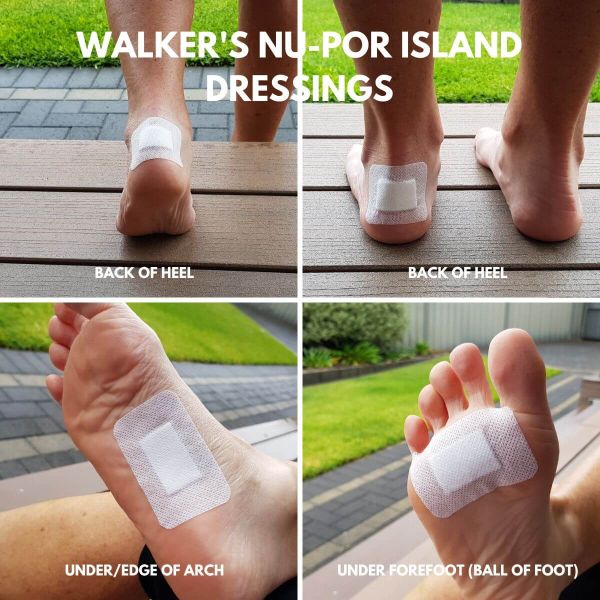 Walker's Nu-Por Island Dressings on feet